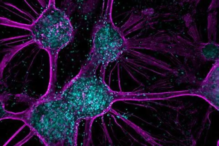 Microscopic image of neurons taken by Nikky Corthout &amp; Jasper Timmerman that look like purple spaghetti with blue meatballs