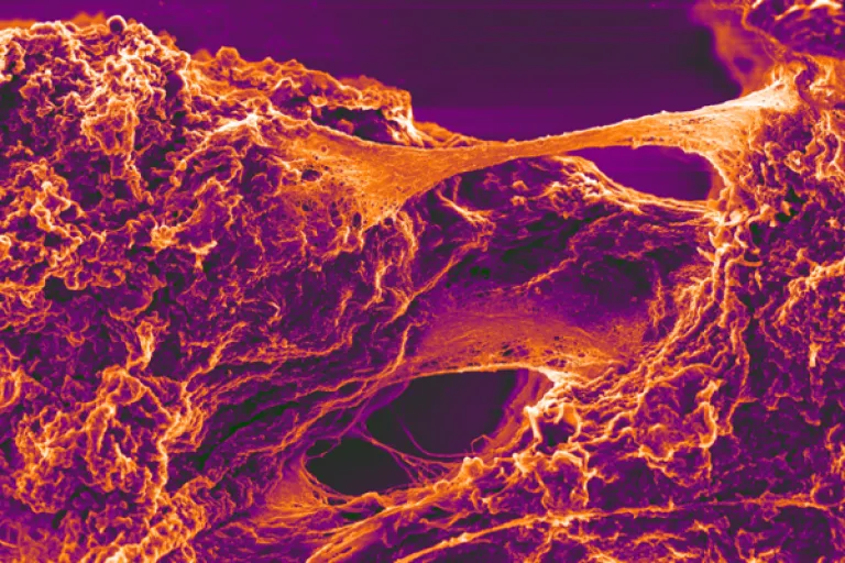 macrophages generating Aβ fibrils